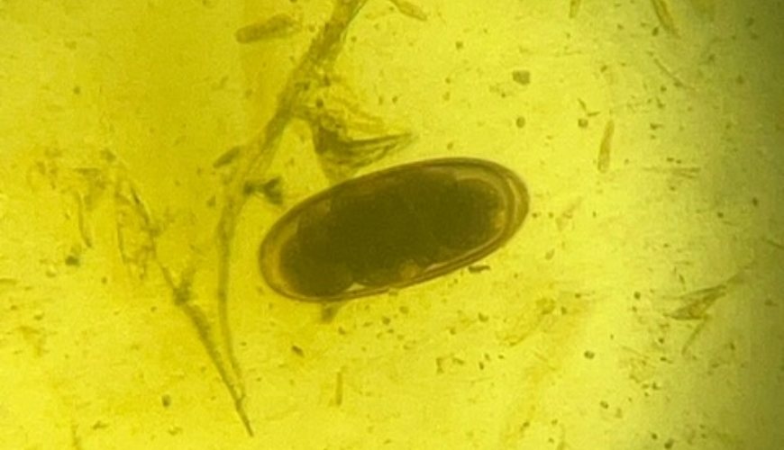 A microscope image from a faecal egg count 